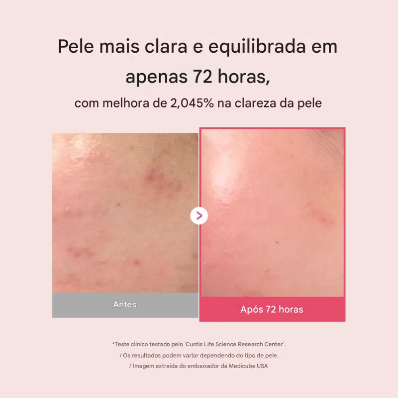 Sérum Facial Medicube TXA Niacinamide 15% – Clareador de Manchas e Uniformizador da Pele