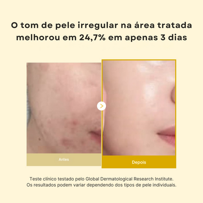 Máscara Facial Noturna com Ácido Kójico e Cúrcuma
