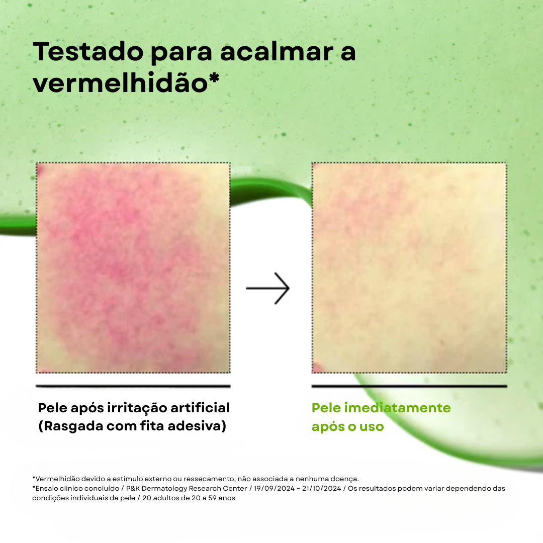 Sérum Calmante com Ácido Azelaico 10% e Ácido Hialurônico