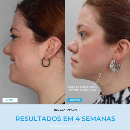 Liftlab — Modelador Facial Rejuvenescedor com Sérum Grátis