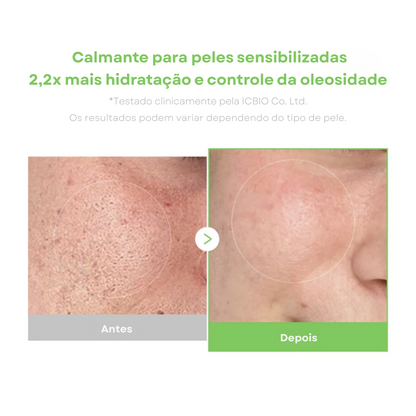 Creme Calmante com Cica e Exossomos