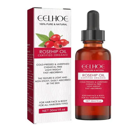 Óleo de Rosa Mosqueta Puro – Hidratação, Renovação e Brilho Natural